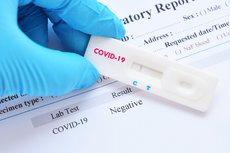 Российские медики провели более 112 млн тестов на коронавирус